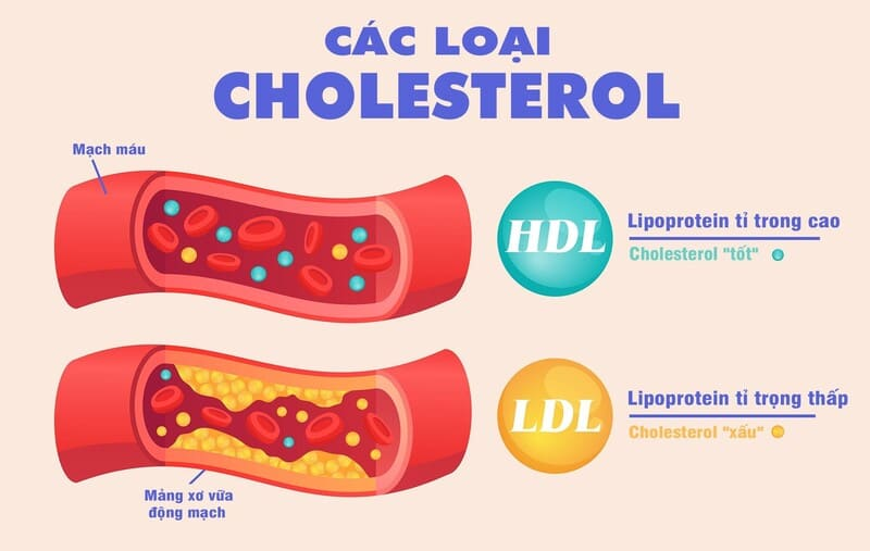 Cholesterol cao: 8 loại thực phẩm vàng giúp giảm mỡ máu và thúc đẩy hệ –  MEDSI